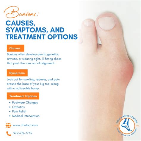 Foot - 👉 Dealing with a painful bump on the side of your big toe? You