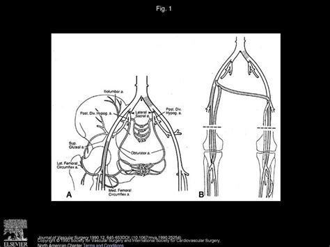 Interruption Of Critical Aortoiliac Collateral Circulation During