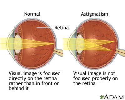 Astigmatism - Been A Better Portal Bildergallerie