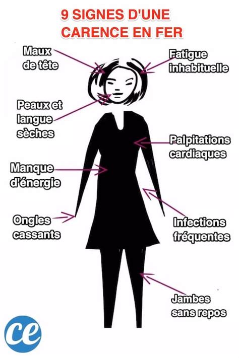 Signes Qui Montrent Que Vous Tes En Manque De Fer Et Nos Astuces