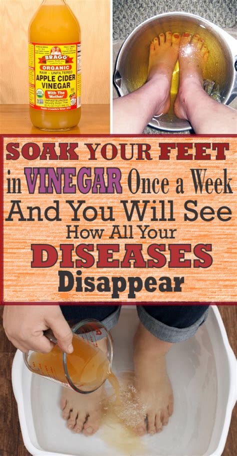 Soak Your Feet In Vinegar Once a Week, And You Will See How All Your Diseases Disappear - Health ...