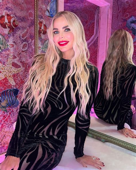 PIC: Alexia Nepola on Why She Had Bruise on Her Face on RHOM