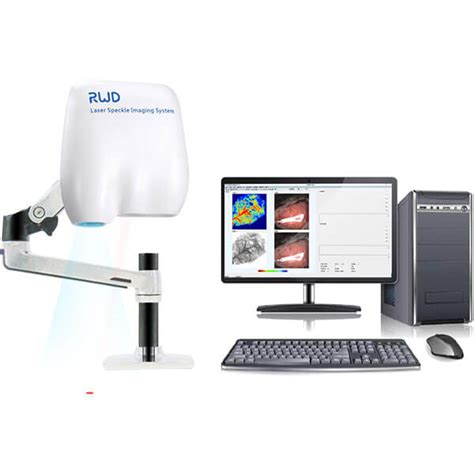 Laser Speckle Contrast Imaging System - PrimeBioscience