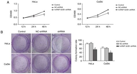 Knockdown Of Hnrnp A B Inhibits Cell Proliferation Invasion And Cell