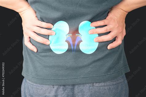 Man Suffering From Low Back Pain With Kidney Anatomy Shape Cause Of