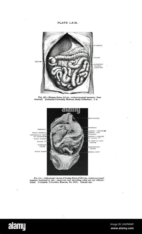 Vertex Anatomy