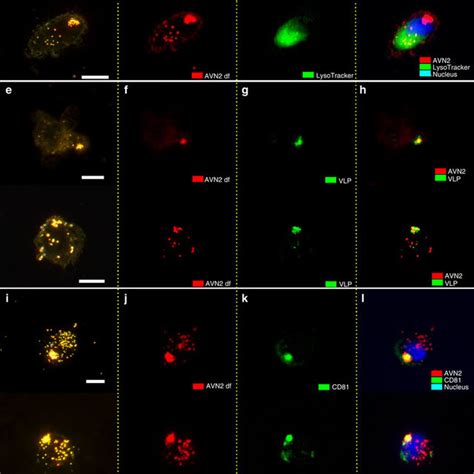 Sequestration Of GM3 Containing AVN2 Particles In Mature DCs A The