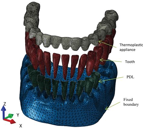 Finite Element Model Of Maxillary Segment With Alveolar Bone