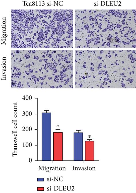 Dleu Is A New Potential Target That Promotes Oral Cancer Development