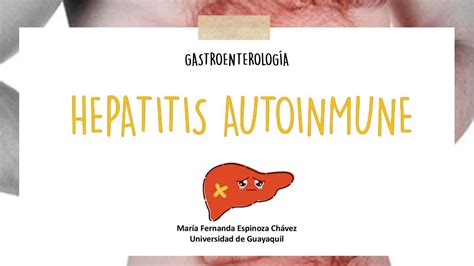 Hepatitis Autoinmune Gastroenterolog A Mis Apuntes Medicos Udocz