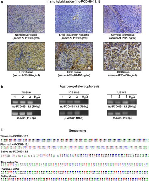 Validation Of Candidate The Lncrna Biomarker A In Situ Hybridization