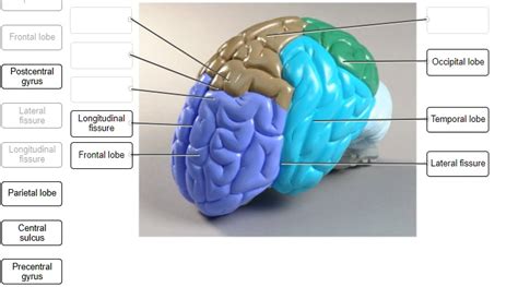 Solved Identify The Structures On This Lateral View Of A Brain Model