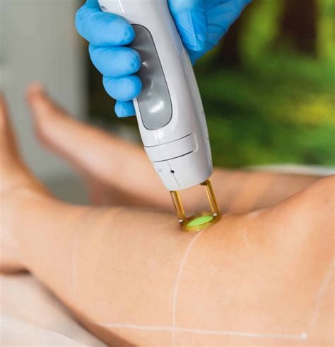 Het Verschil Tussen Laser En Ipl Stralend Skin Body Clinic In Waalwijk