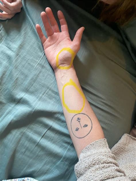Chronic Wristforearm Pain Rclimbergirls