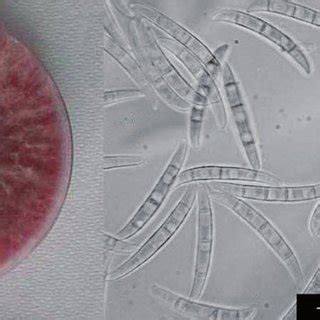 Fusarium Graminearum On Potato Dextrose Agar Pda And Macroconidia