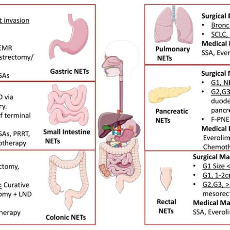 Common Locations And Clinical Features Of Neuroendocrine Tumors