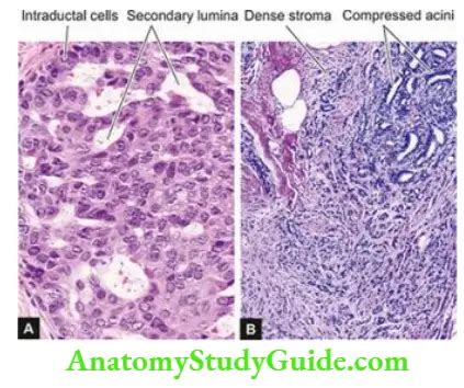 Pathology Of The Breast Notes - Anatomy Study Guide