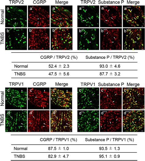 Both Trpv And Trpv Positive Neuron Contained Cgrp And Substance P In