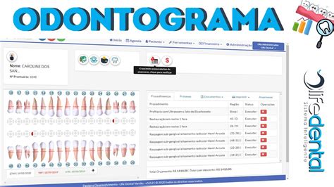 Odontograma Conheça um pouco mais Software Odontológico Life