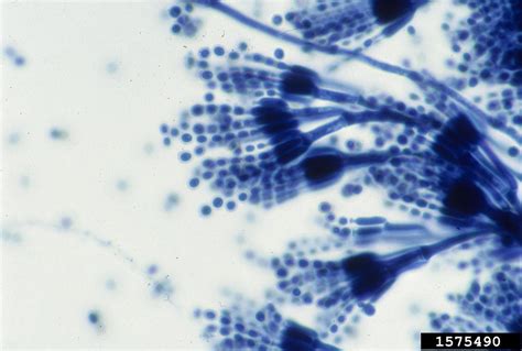 Penicillium Fungi Penicillium Spp Eurotiales Trichoco