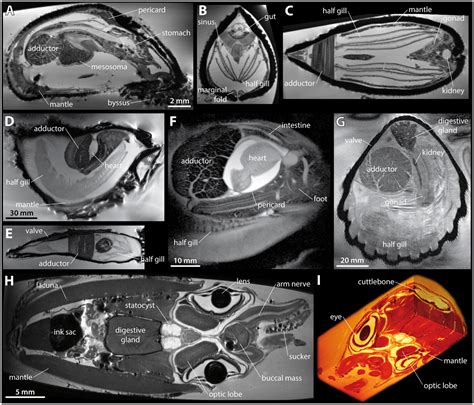 4 dimensional imaging is changing how doctors see the human body 3