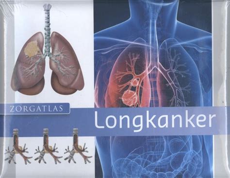 Bureau Isbn Longkanker