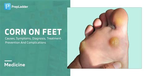 Corn On Side Of Foot Images Store