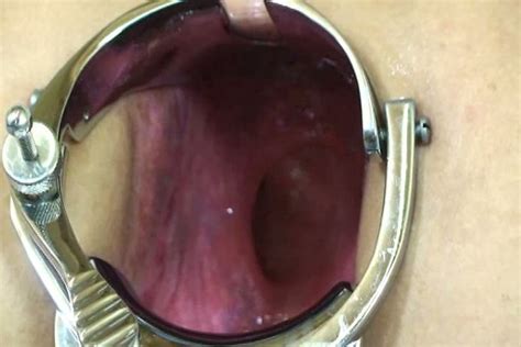 Speculum Eliminabile Vaginale Con Lo Speculum S M L Xl Hot Sex Picture