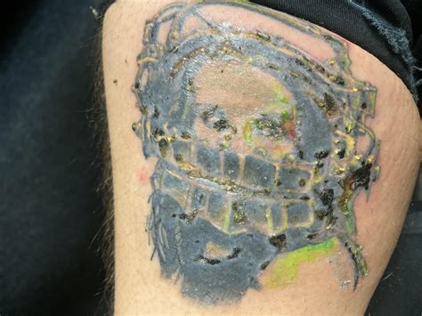 it’s time to play, is this tattoo infected or just scabbed? thank you