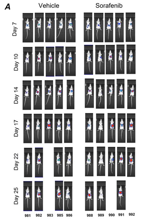 Orthotopic Liver Cancer Model In Athymic Nude Mice