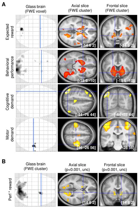 Neural Correlates Of Main Experimental Factors And Effects Reward