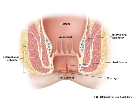 Can Pelvic Floor Physical Therapy Help With Anal Fissures Pelvic