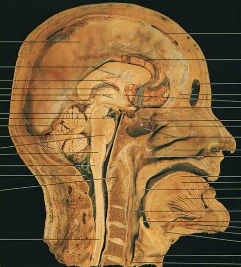 Median Sagittal Section Through The Head And Neck Diagram Quizlet