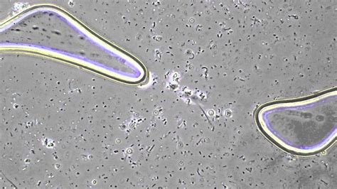 Yoghurt bacteria - YouTube
