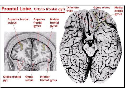 Anatomy of brain sulcus and gyrus - Dr.Sajith MD RD