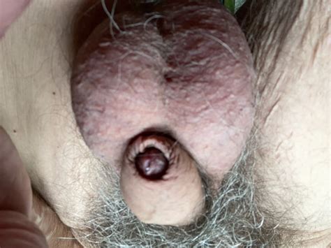 Uncut Greek Mature 5 Nude Pics XHamster