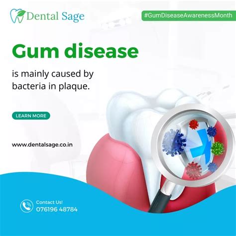 Ppt Gum Disease Best Dental Clinic In Yelahanka Bangalore Dental