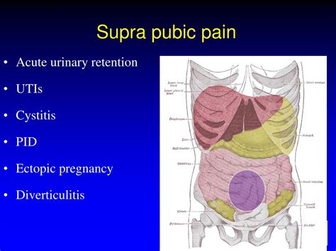 Suprapubic Pain Icd 10 Asking List