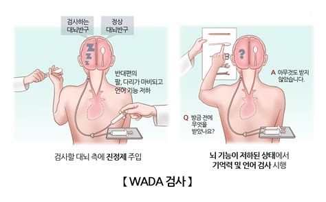 검사시술수술정보 의료정보 건강정보 서울아산병원