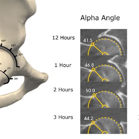Alpha Angle And Center Edge Angle Measurements Are Shown In Steps Of