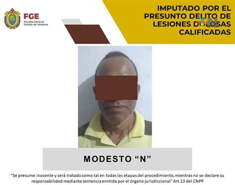 Modesto N Es Imputado Por Presunto Delito De Lesiones Dolosas