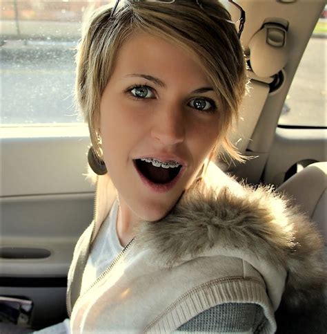 Pin By Singsing On Braces Girls Braces Girls Blonde Hair Girl Dental Braces