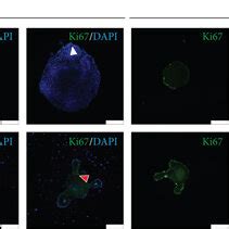 Tjp Expressions Of Intestinal Organoid With Tnf Treatment Qrt Pcr