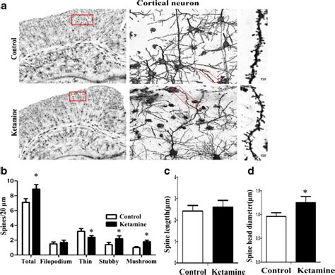 Ketamine Promotes The Dendrite Maturation Of Rat Cerebral Cortex A