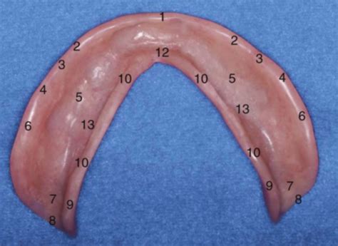 Mandibular Denture Landmarks Diagram Quizlet