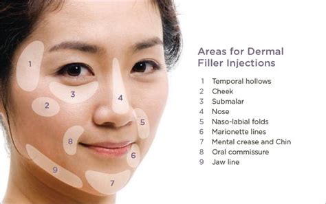 frequently asked questions  dermal fillers cosmetique aesthetics