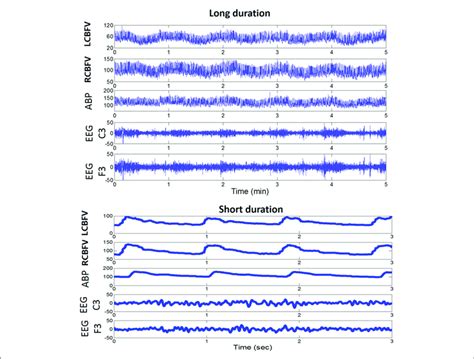 An Example Of A Daily Recording Of Cbfv Abp And Eeg In A Neuro