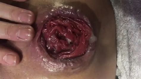 Moscou Fisting Anal E Vaginal XHamster