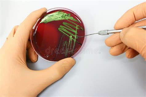 Microbiology Science - Bacteria Culture Stock Photo - Image of plate ...