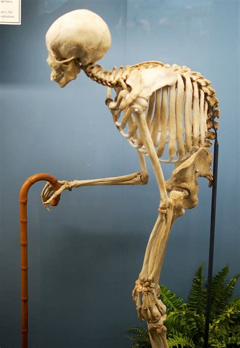 Остеопороз. Здоровье костей или Готовь сани летом. — Хлеб да каша